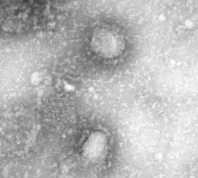 新冠病毒比非典更容易传染吗？
