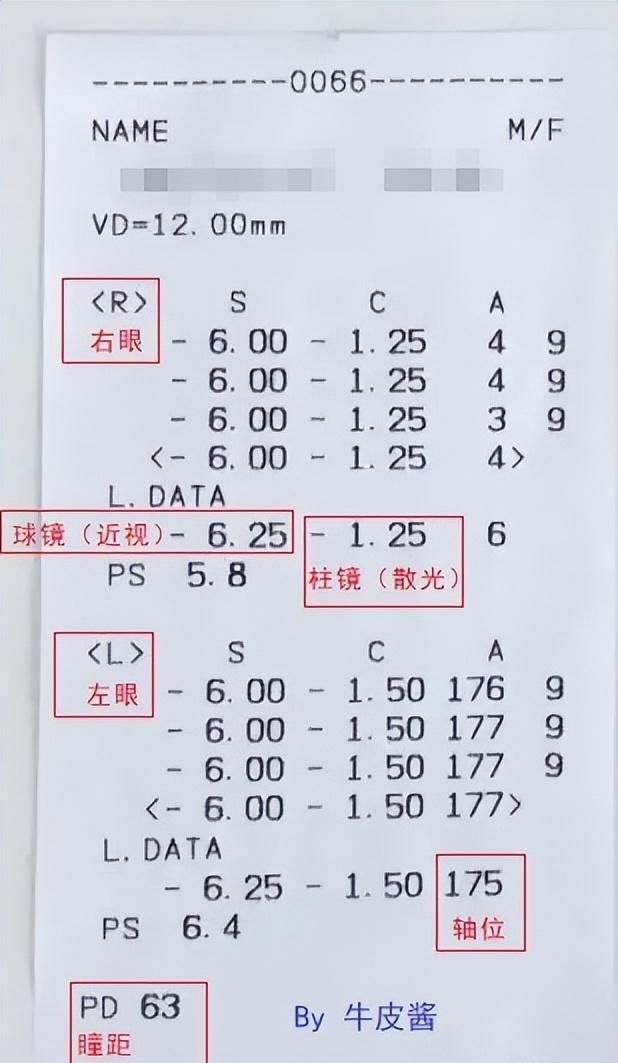 「干货分享」亲身经历告诉你，网上配镜到底有多省钱